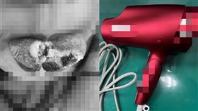 女童拔「吹風機插頭」塞嘴！舌頭全燙爛