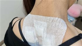 三伏貼(讀者提供)