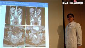 0111三總放射腫瘤部主任羅承翔(記者黃仲丘攝影)