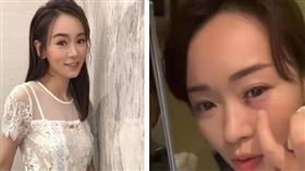 楊思琦近期正在大陸江蘇拍攝電影的她，眼睛竟受傷意外，差點失去視力。（圖／翻攝自楊思琦IG）