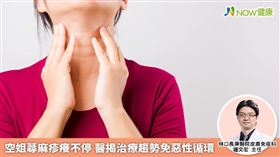 名家／林口長庚醫院皮膚免疫科鐘文宏主任表示，臨床上慢性蕁麻疹患者女性多於男性，由於女性對蕁麻疹忍受度低，加上較為敏感，因此情緒變化及精神壓力累積，很多人甚至會合併焦慮症。（勿用）