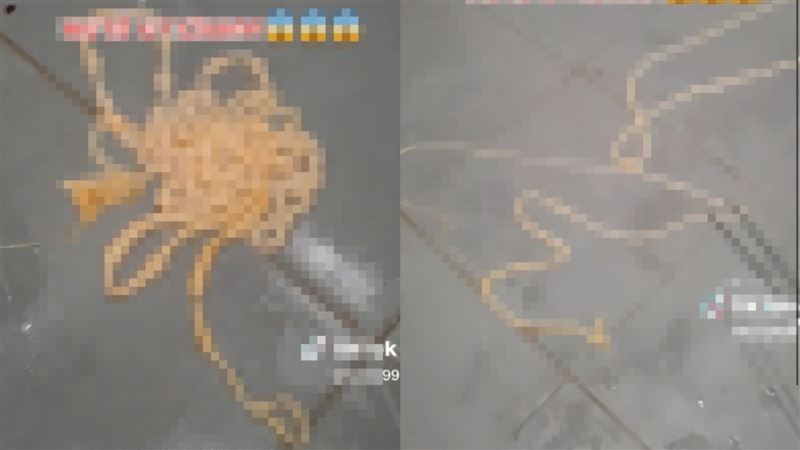 連3年愛吃生牛肉！男腹痛拉出2公尺蛔蟲