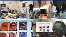 0116幽門桿菌胃相系統(台大醫院提供)