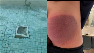 水療池排水口破裂房客險死　業者道歉了