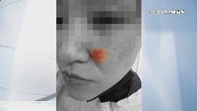 文 護理慘遭打1200