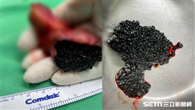 黃漢斌醫師授權提供