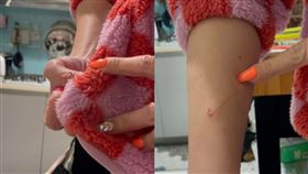 手臂被新外套劃傷
圖/翻攝自爆怨公社臉書