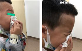 長期戴口罩戴出問題！兒醫點這病正流行(圖/台中醫院提供)