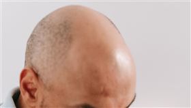禿頭。（圖／翻攝自pexels）