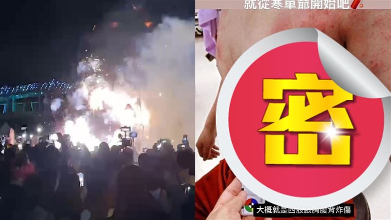 炸寒單炸傷送醫！女醫：急診室都是炸藥味