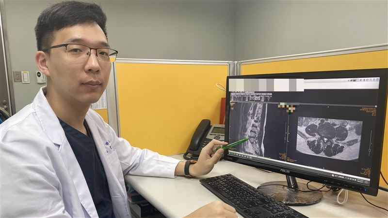 搬運工坐骨神經痛　脊椎內視鏡助擺脫輪椅