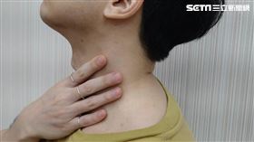 0208吞嚥困難頭頸癌示意(記者黃仲丘攝)