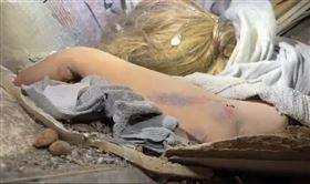 台灣　搜救隊　截肢　土耳其　地震（圖／翻攝畫面）