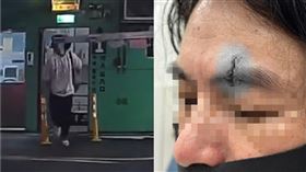 停車場,柵欄,傷口,繳費,爆料公社(翻攝自 爆料公社)