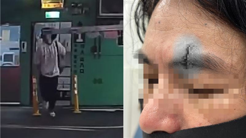 停車場「撞上天降柵欄」！他滿臉血縫8針