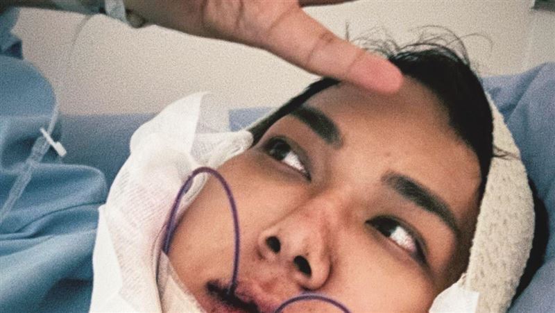 關韶文花50萬正顎　手術後腫變豬頭照片曝
