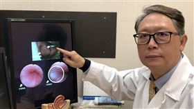 0215周固泌尿道憩室(書田診所提供)