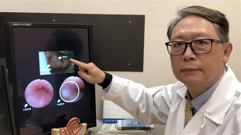 36歲女性交疼痛　尿道竟長這東西