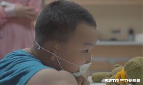 小耳症男孩成成／羅慧夫顱顏基金會提供