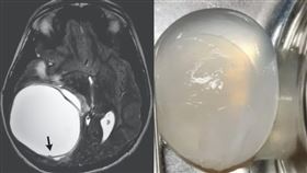 （圖／翻攝自The New England Journal of Medicine）