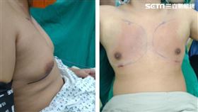 台中男子有男性女乳症，遭嘲笑自卑，透過抽脂手術改善。張育誠醫師。（圖／中港澄清醫院提供）