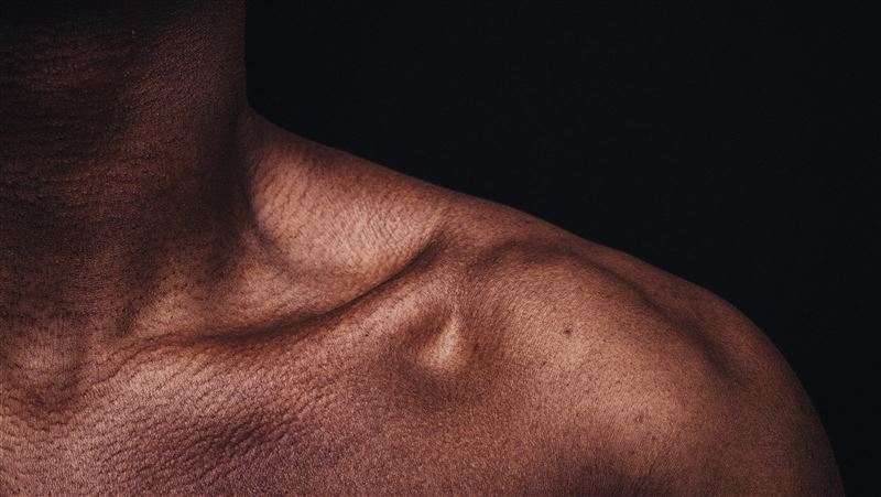 肩痛2年找無原因　醫師一照：肺癌轉移