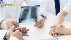 隨著醫學與科學進步，肺癌治療藥物更加多元，肺癌患者的存活期相較過去已延長許多。