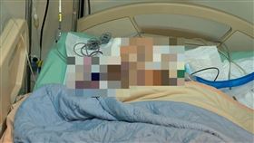 豐原7歲男童練柔道，遭教練學長重摔，腦死昏迷，