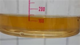 肌肉損傷導致肌球蛋白分子進入血液，再從腎臟代謝，造成小澄的尿液呈現深褐色。（圖／翻攝畫面）