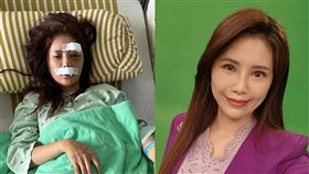 美女主播宋燕旻去年底騎自行車不慎嚴重摔傷。（圖／翻攝宋燕旻臉書）