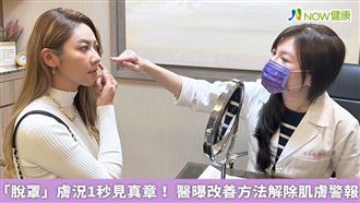 名家／高爾夫球網紅美女Eva因肌膚困擾，特別向呂佳儒醫師求診，最後選擇使用PLT來獲得改善。（勿用）