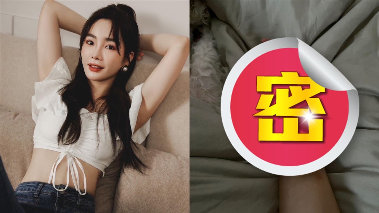 滿手瘀青照曝光　女星嘆：往死裡打
