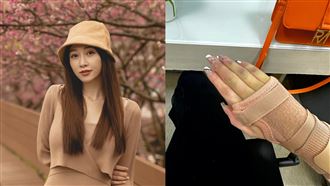 ▲篠崎泫摔倒後被誤診兩次，雙手手掌目前都是骨折狀態。（圖／翻攝自篠崎泫臉書）