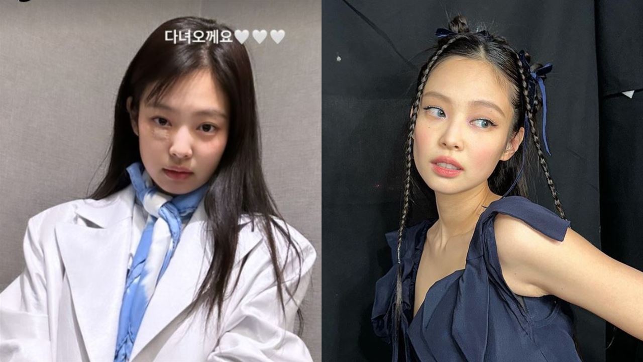 Jennie摔臉首曬破相照！腫脹傷處網嚇壞