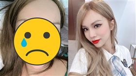 ▲小A辣右眼傷勢嚴重，讓不少粉絲留言讓她好好保重。（圖／翻攝自小A辣IG）