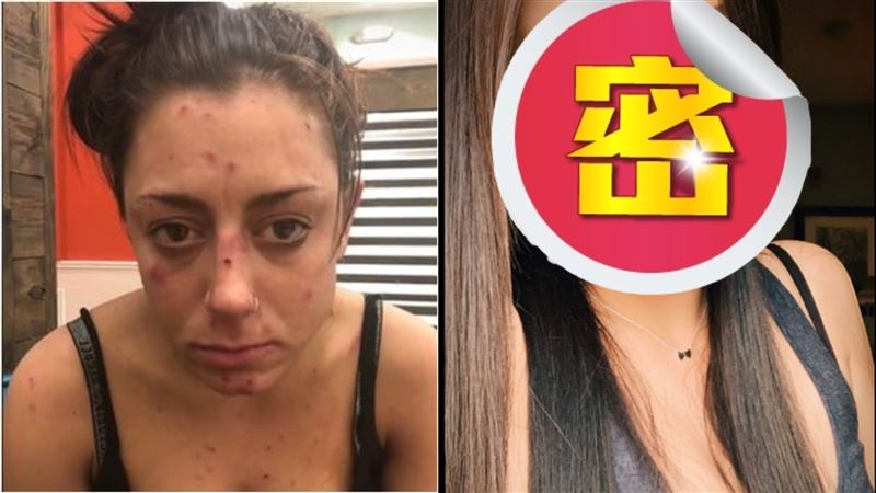 她吸毒吸到滿臉爛瘡!戒毒3年仙氣爆棚