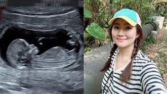 Selina驚爆有4顆肌瘤！懷孕初期孕肚超大