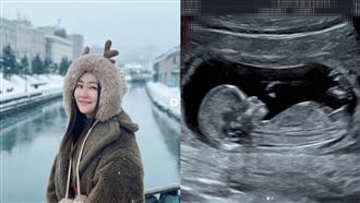 Selina宣布懷孕首發聲　寶寶小名含義曝