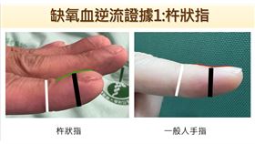 手指，心臟,水腦(圖／翻攝畫面）