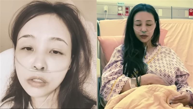 M字腿女王車禍！氣血胸險喪命　病床照曝