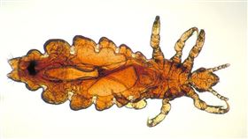 頭蝨(美國疾病管制與預防中心)