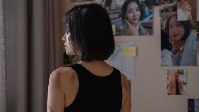《黑暗》文同珢燙傷疤可修復？醫揭5作法
