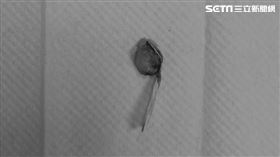 南投男童鼻子塞大蒜，就醫才取出。（圖／部立南投醫院提供）