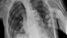 醫揭X光片「多1隻手」！看護1句話全場背脊發涼　驚人真相曝光了。（圖／翻攝自蘇一峰臉書）