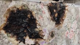 電毯燒屁.股0930