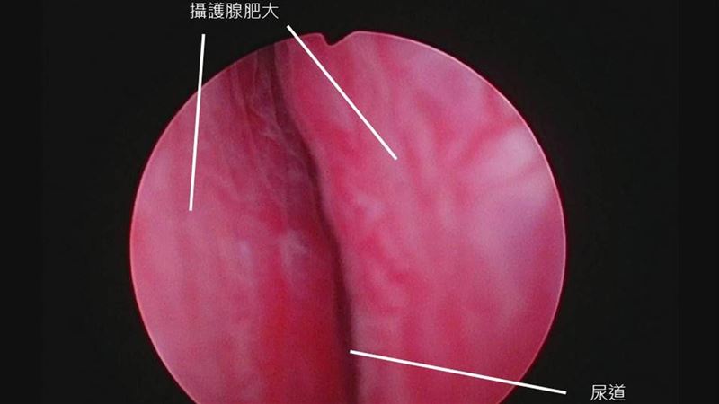 男人都希望「愈大愈好」？1個部位例外