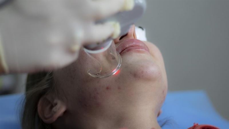肝不好「皮膚會警告你」　醫曝4大異象