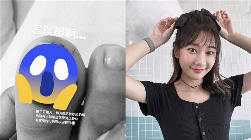 愛莉莎莎爆意外送急診！事發過程超驚悚