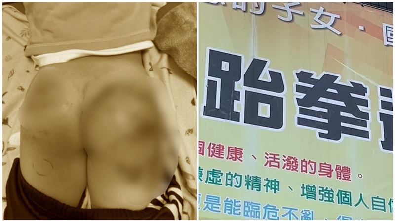 男童屁股被毒打整片瘀青 跆拳女教練慘了