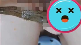 快感,尿道,水蛭,中國,微博,許超（圖／翻攝自微博）